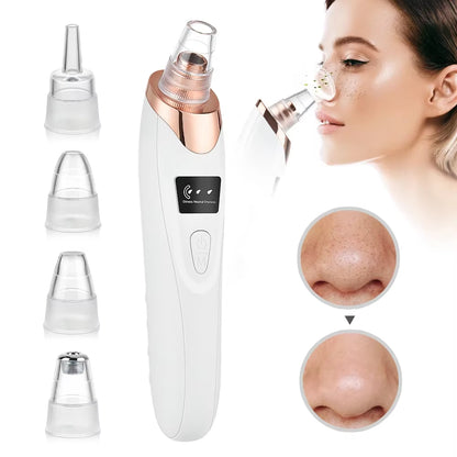 Electric Blackhead Remover Vacuum – Deep Pore Cleanser & Face Care Tool